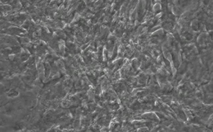 通过直接重新编程制造心肌诱导心肌样细胞（iCM细胞：induced cardiomyocytes）